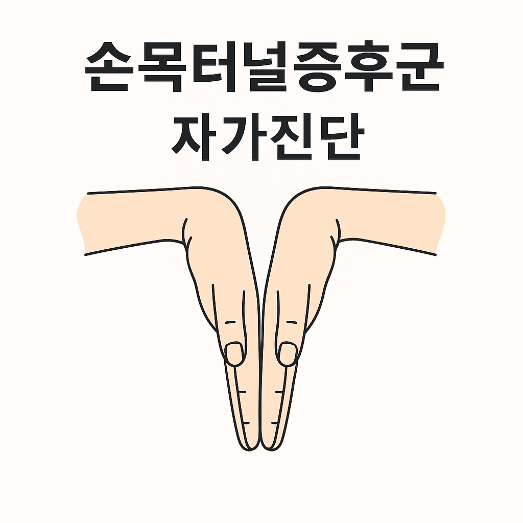 손목터널증후군 자가진단_팔렌검사