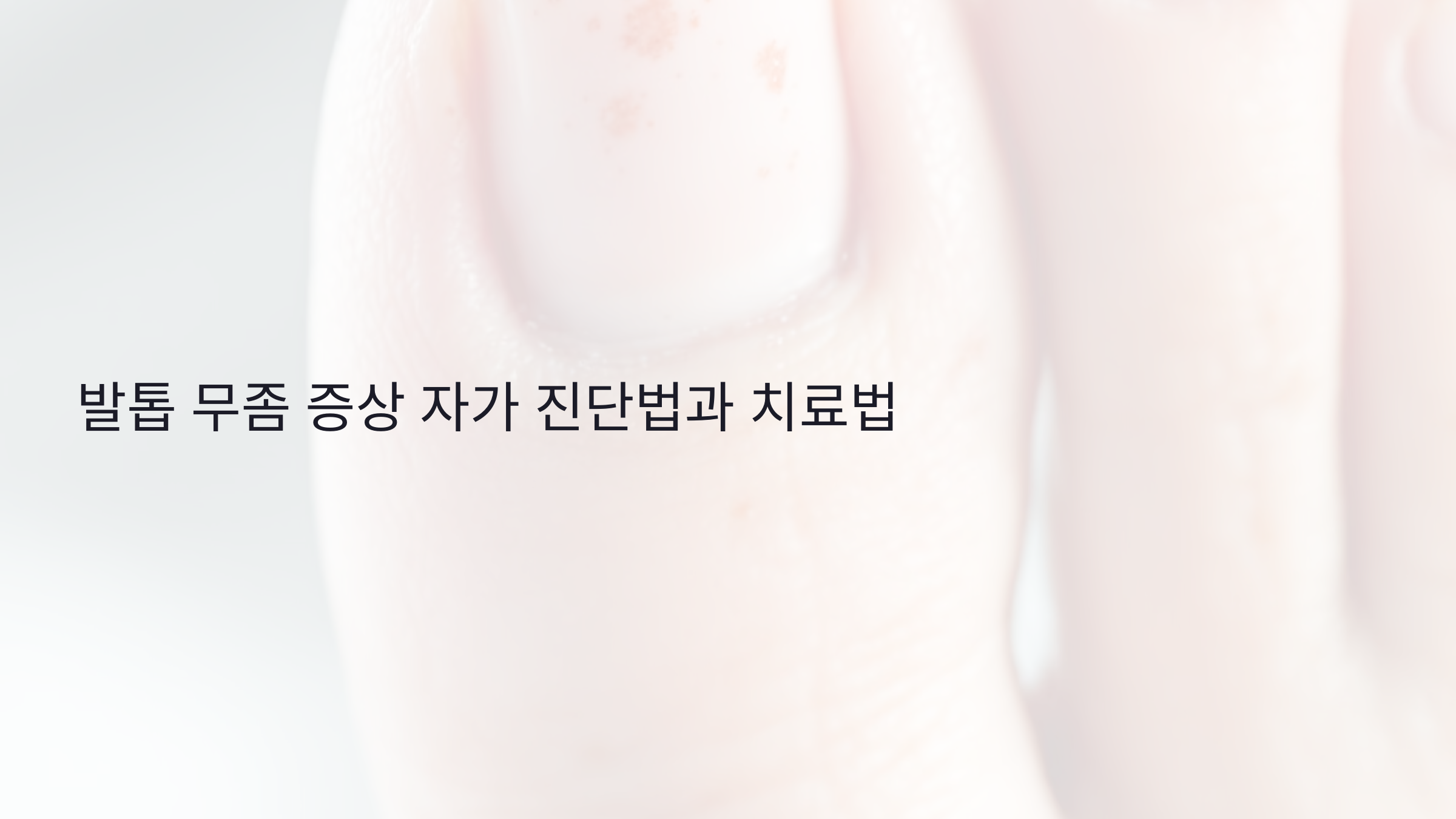 발톱 무좀 증상 자가 진단법과 치료법: 지금 시작해야 하는 이유