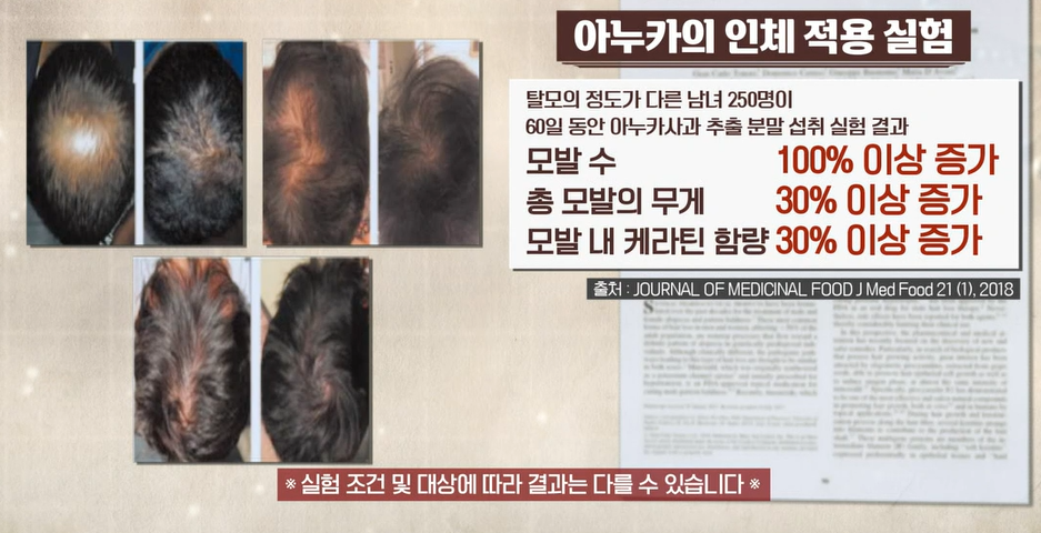 아누카사과효능