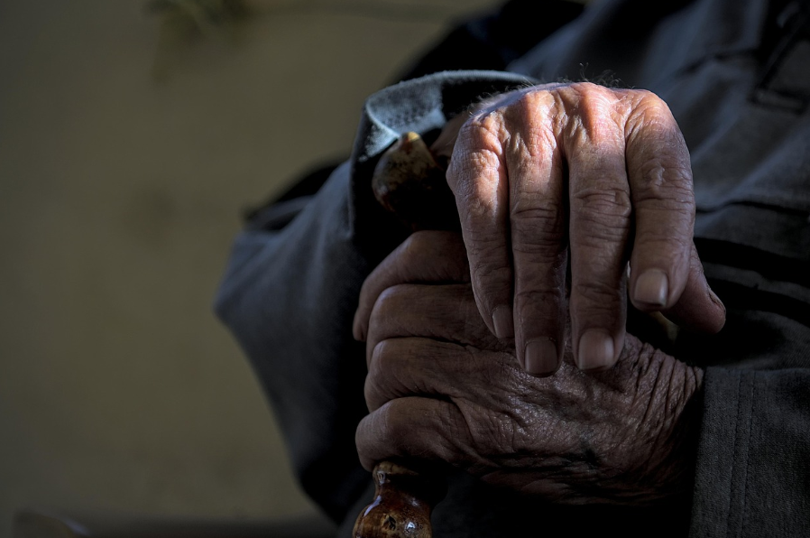 노화속도 측정법