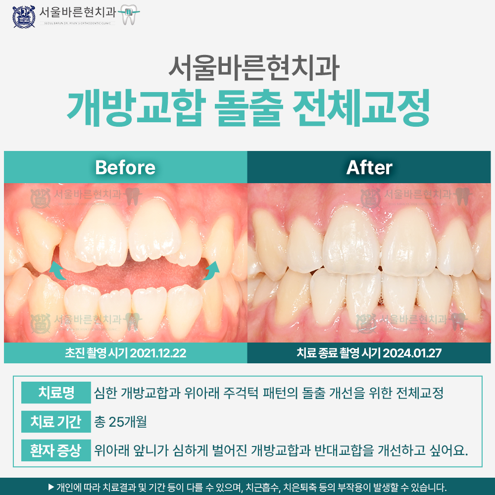 부산교정치과