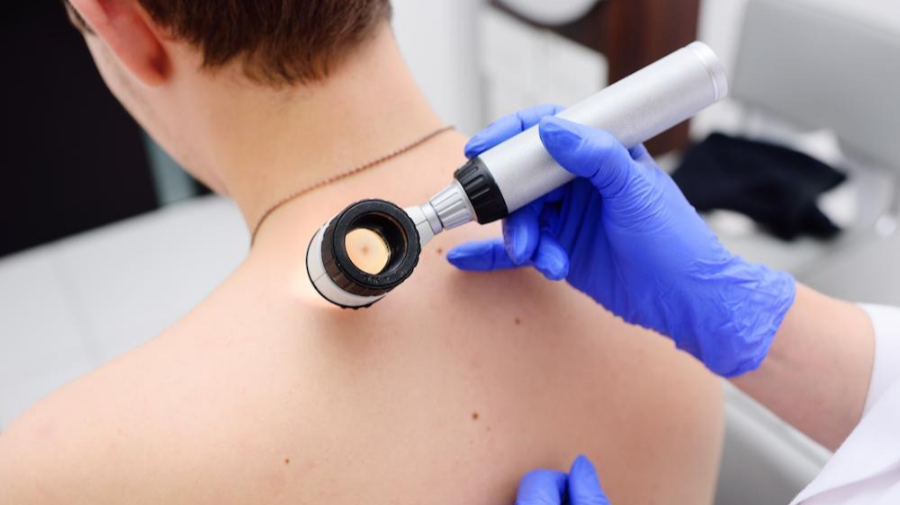 백반증 완벽 가이드