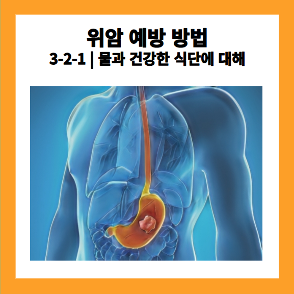 위암 예방