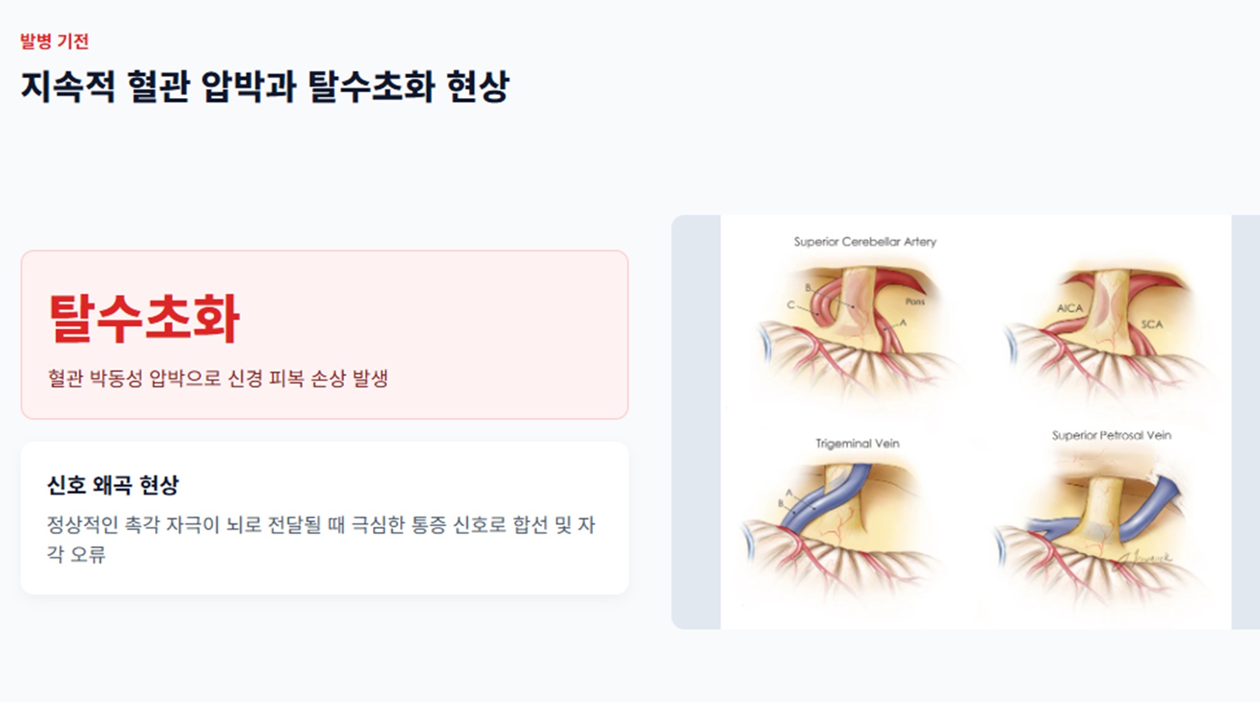 탈수초화