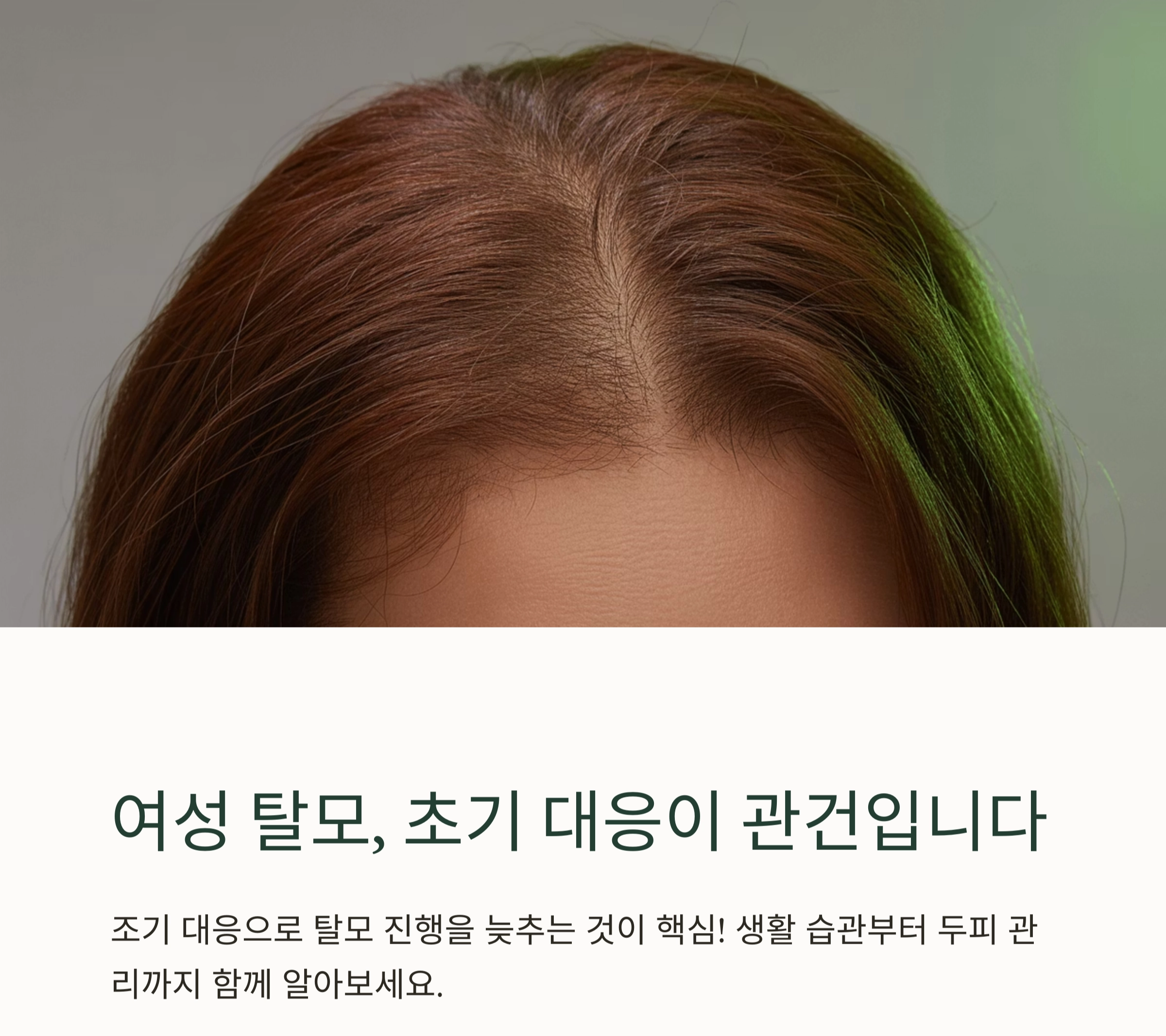 여성 탈모 초기 대응, 관리법만 알면 두피도 되살아납니다