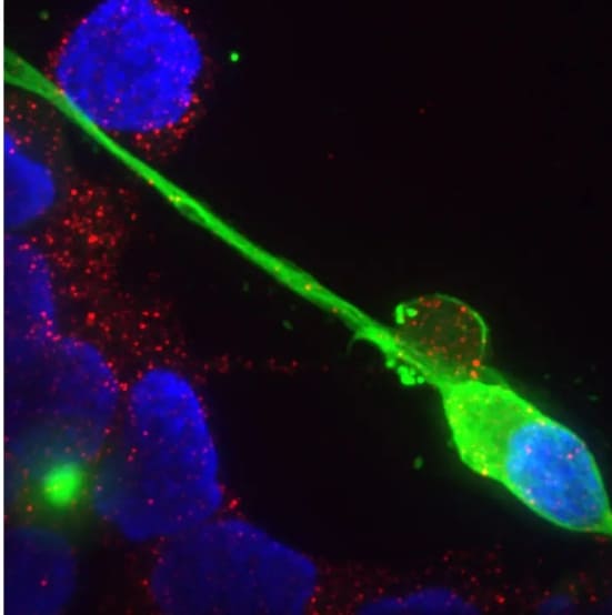 롱 코비드, 장기에 의한 각종 감각 손상 증상 유발...종합적 치료해야: MIT MIT 'Gut Instinct' Cause for Numerous Sensory Symptoms in Long COVID, Doctors Offer Comprehensive Treatment