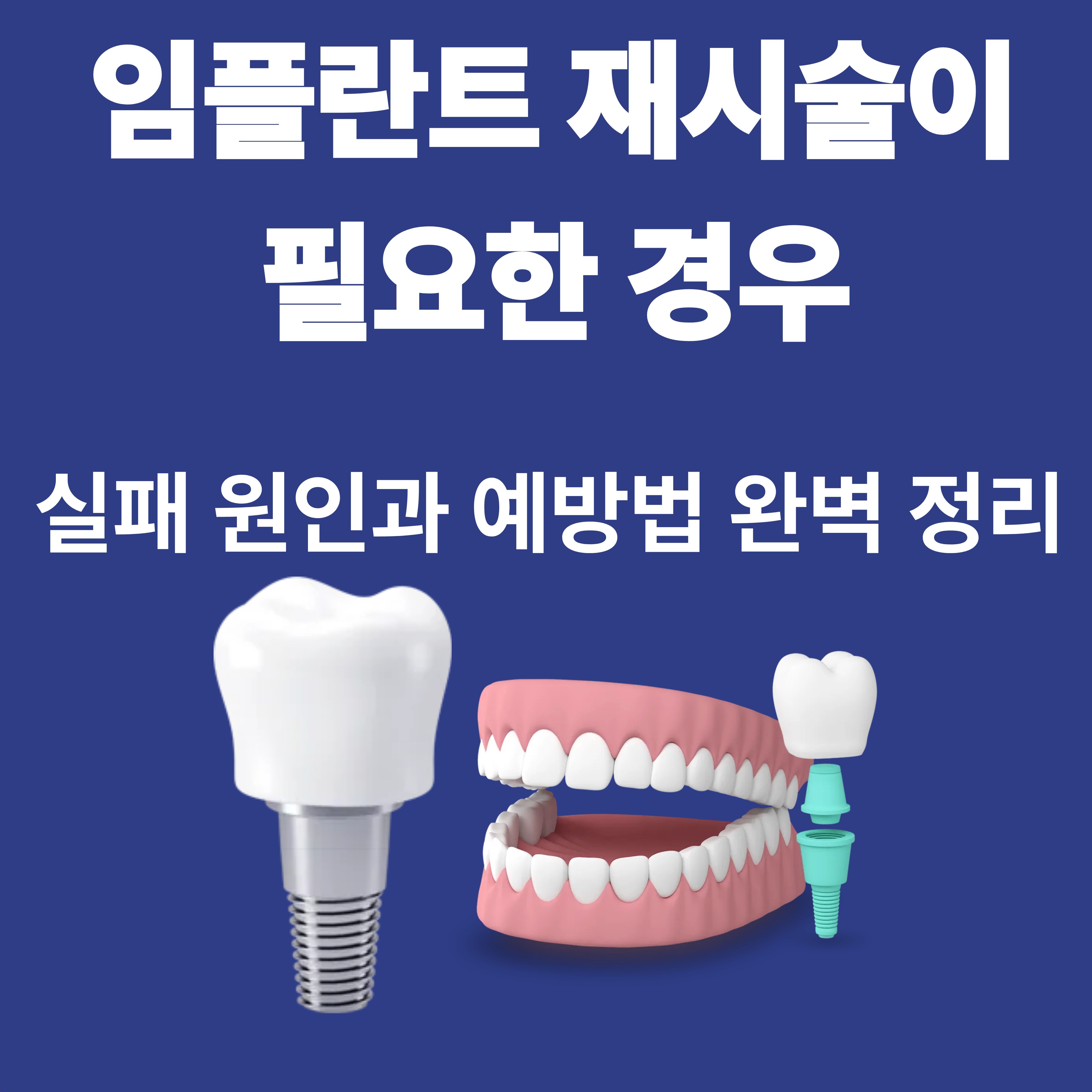 임플란트 재시술이 필요한 경우-실패 원인과 예방법 완벽 정리
