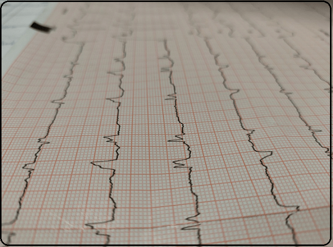 심장맥박검사결과