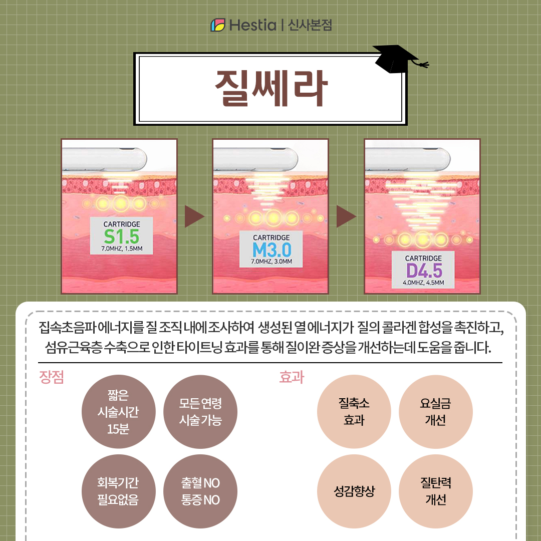 질쎄라 정확히 뭔가요?