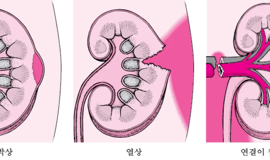 신장에 좋은 음식