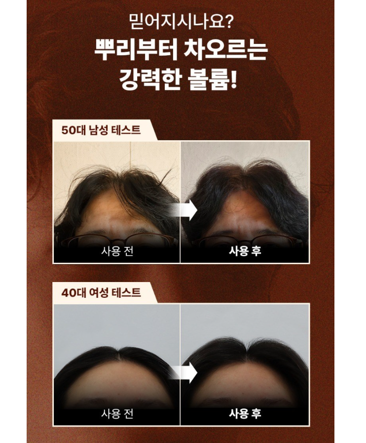 트리코엑스 샴푸 후기