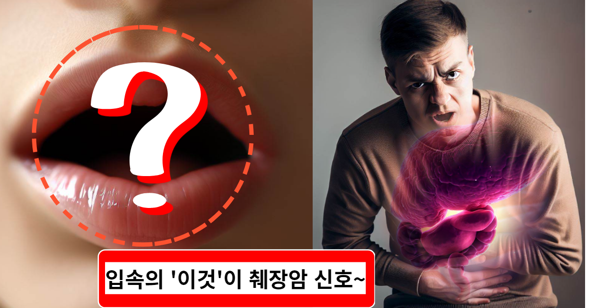 입속에 '이것' 보이면 절대 방치하지 마세요