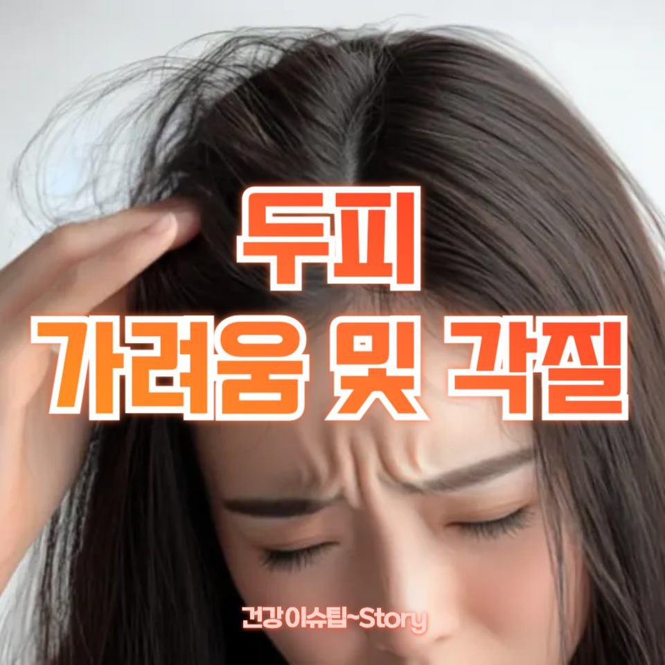 두피 가려움 및 각질