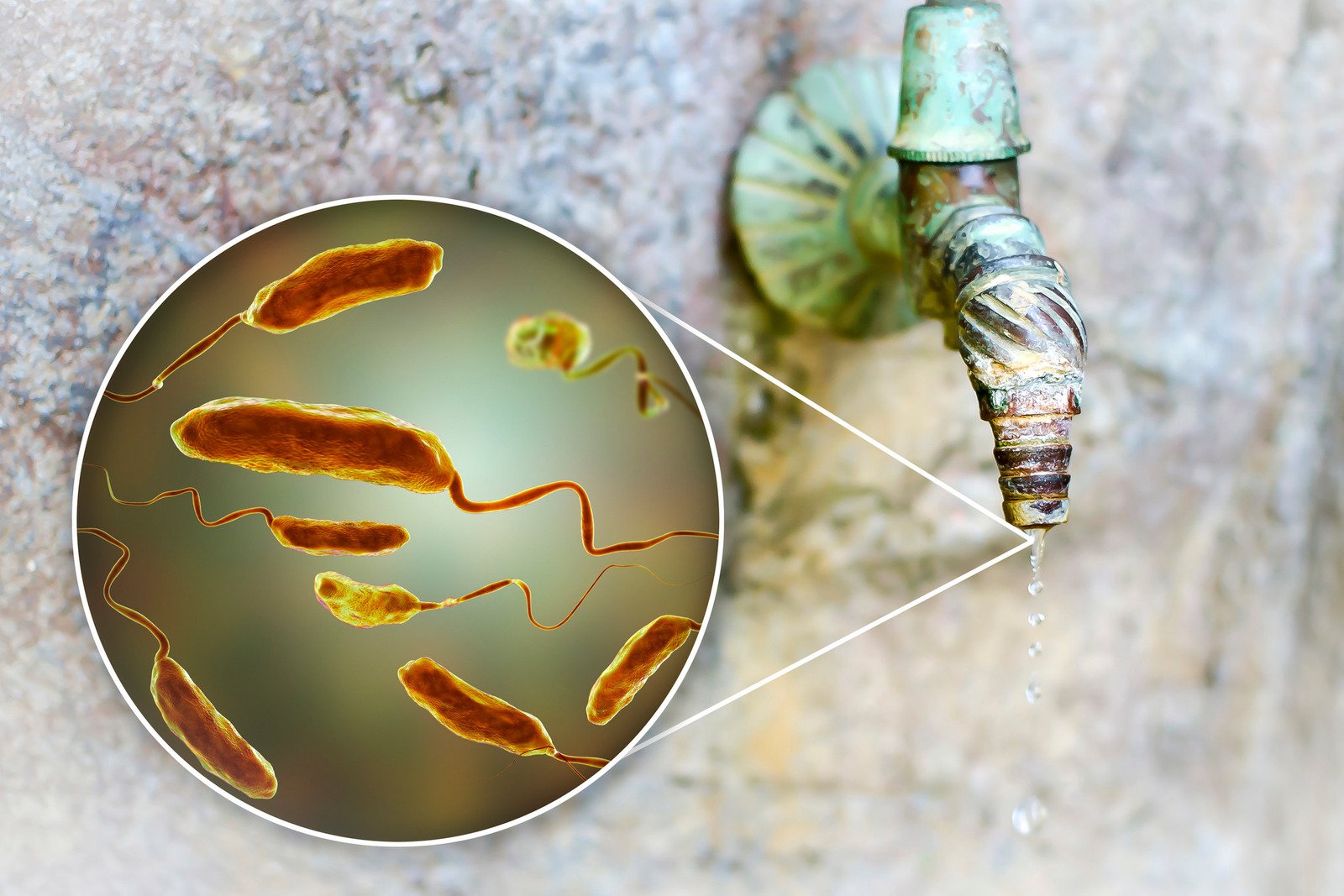 비브리오 패혈증