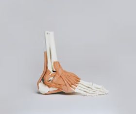 류마티스 관절염 초기증상 치료 원인 예방법