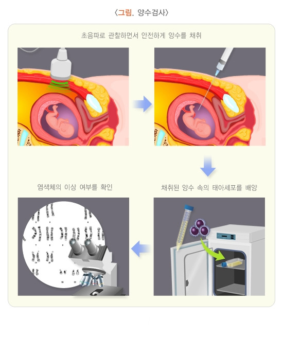 양수 검사