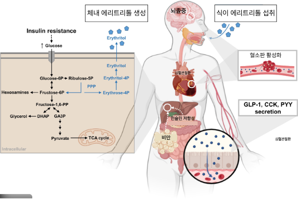 에리트리톨, 뇌졸중 위험 증가 연구 결과 관련 이미지