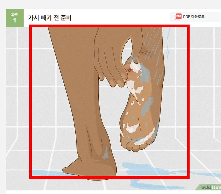 손가락 가시 빼는법 소개