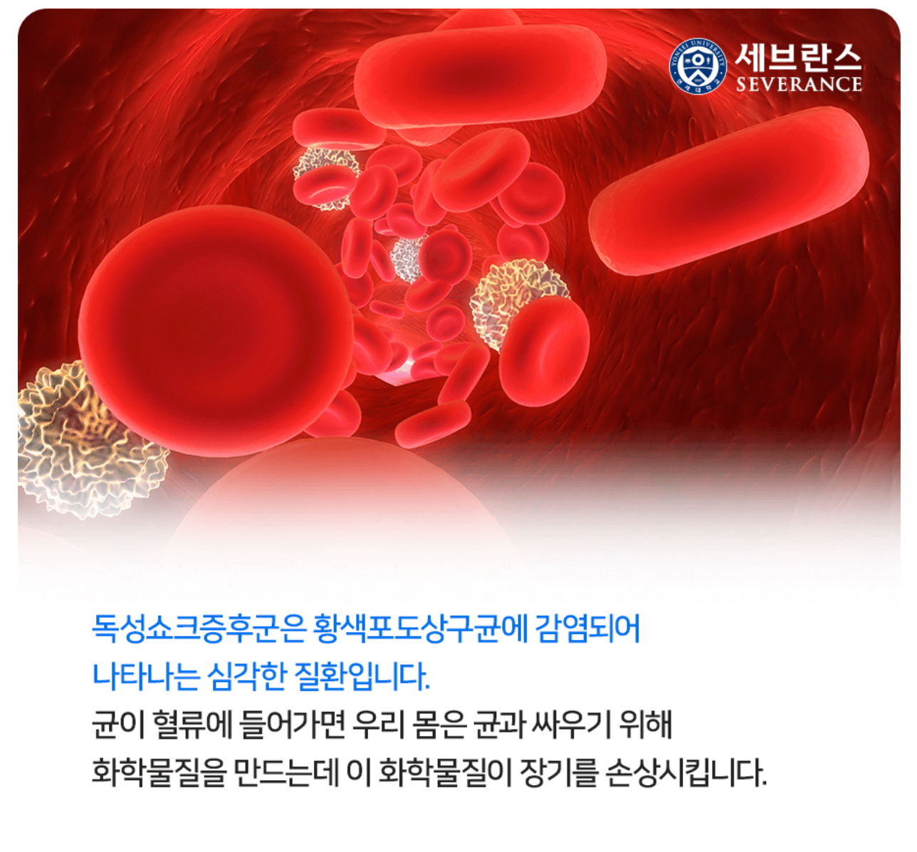 일본 감염병 연쇄구균 독성 쇼크 증후군 치사율 증상 예방법
