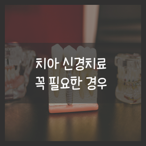 치아 신경치료 꼭 필요한 경우