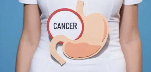 Epigenetics–Metabolomics 연결 분석: 암 대사 리프로그래밍 규명