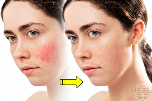 슈퍼푸드 오트밀 효능 피부,오트밀 먹는법