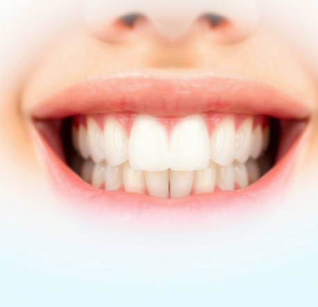 잇몸에-좋은-치약-추천-잇몸케어-치약