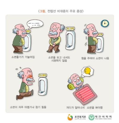 전립선 비대증
