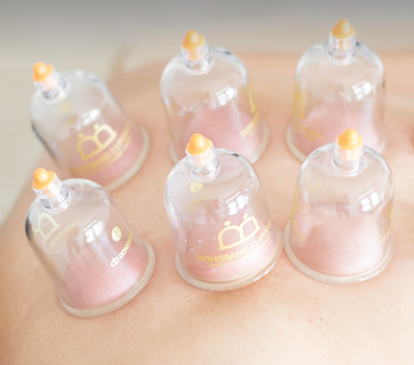 부항 치료, 어떤 질환에 효과적일까?