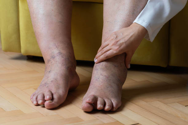 혈액순환에 좋은 영양제 BEST5!!