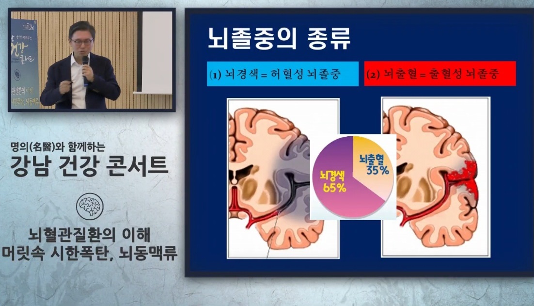 EBS-명의-뇌동맥류-김용배-교수-신경외과-뇌출혈