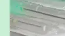 알부민 주사 가격