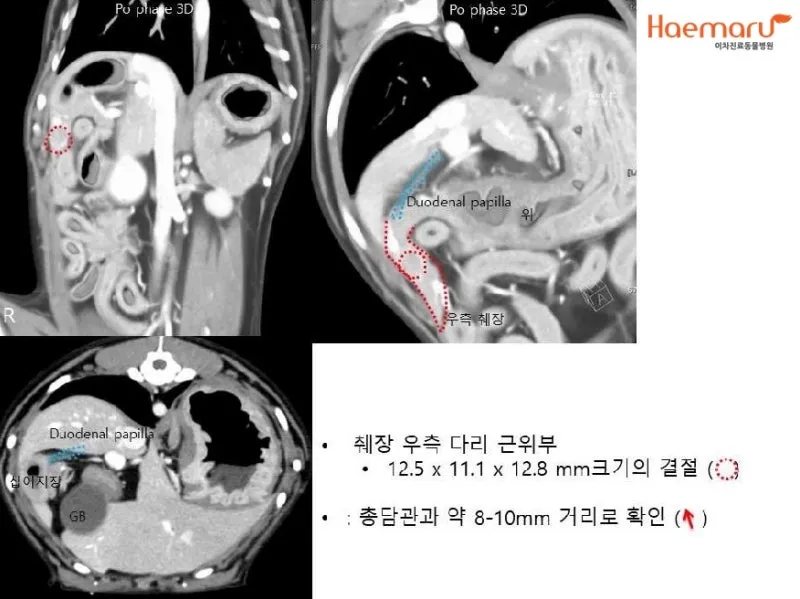강아지 췌장암 증상 진단 치료법 안내_1