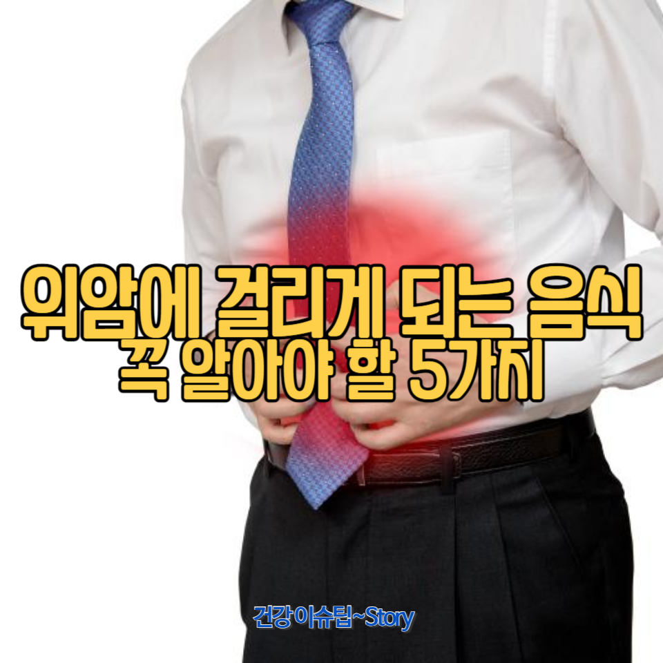 위암을 유발하는 음식들과 이를 피하기 위한 방법을 소개