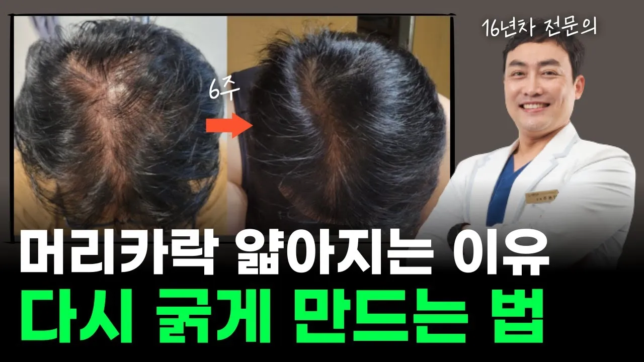 머리카락 굵게 만드는 방법 8가지와 두피관리 팁 안내_5