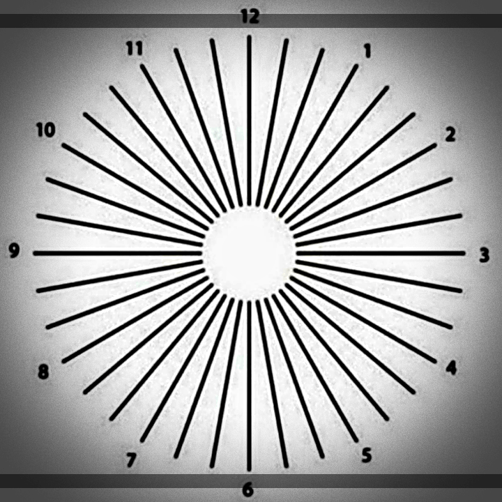 난시-레이디얼-라인-테스트