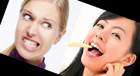 잇몸 내려앉음 치료