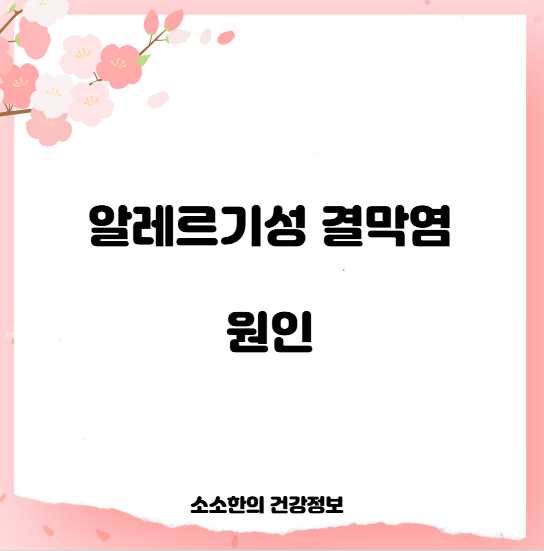 알레르기성 결막염 원인