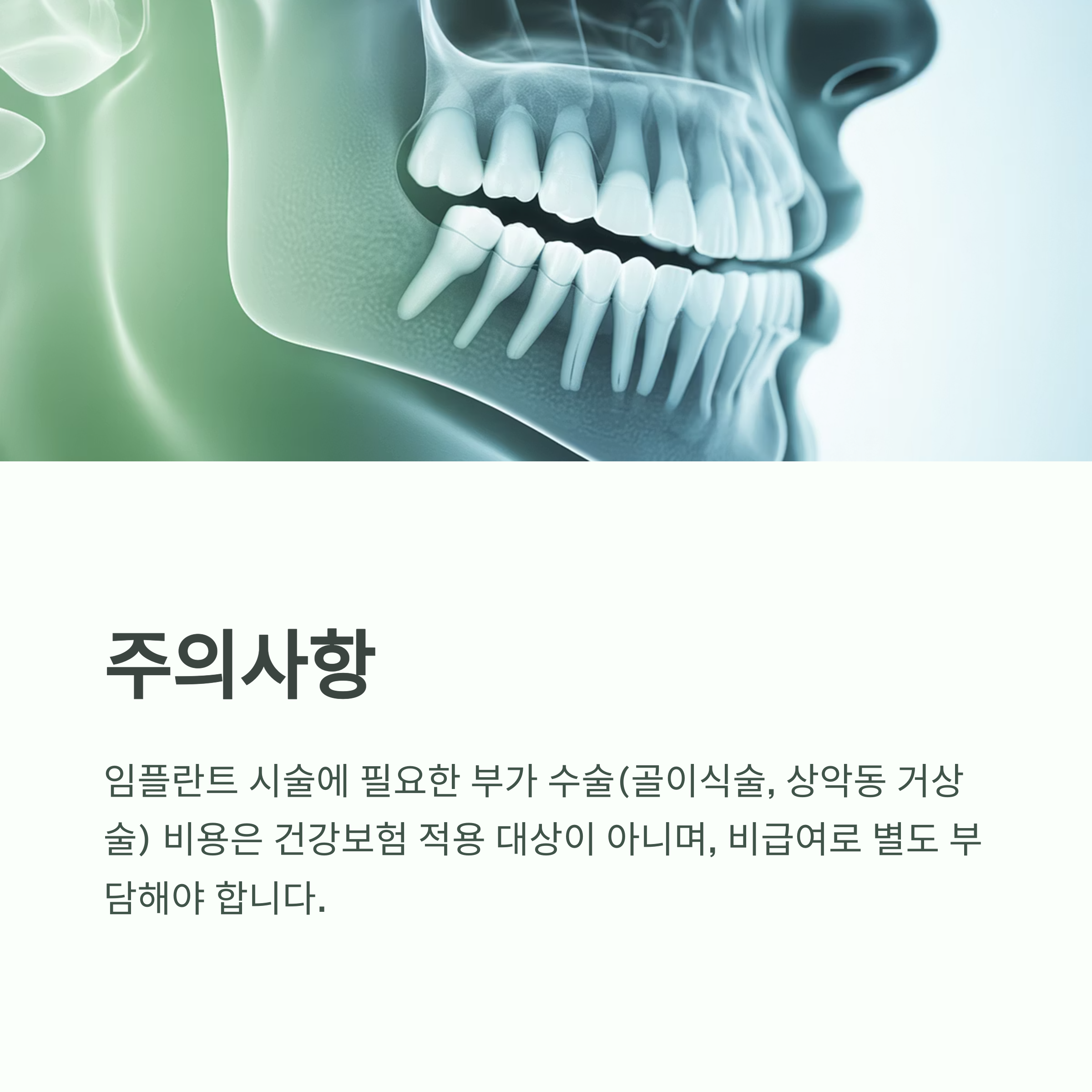 65세 이상 임플란트 건강보험 지원금