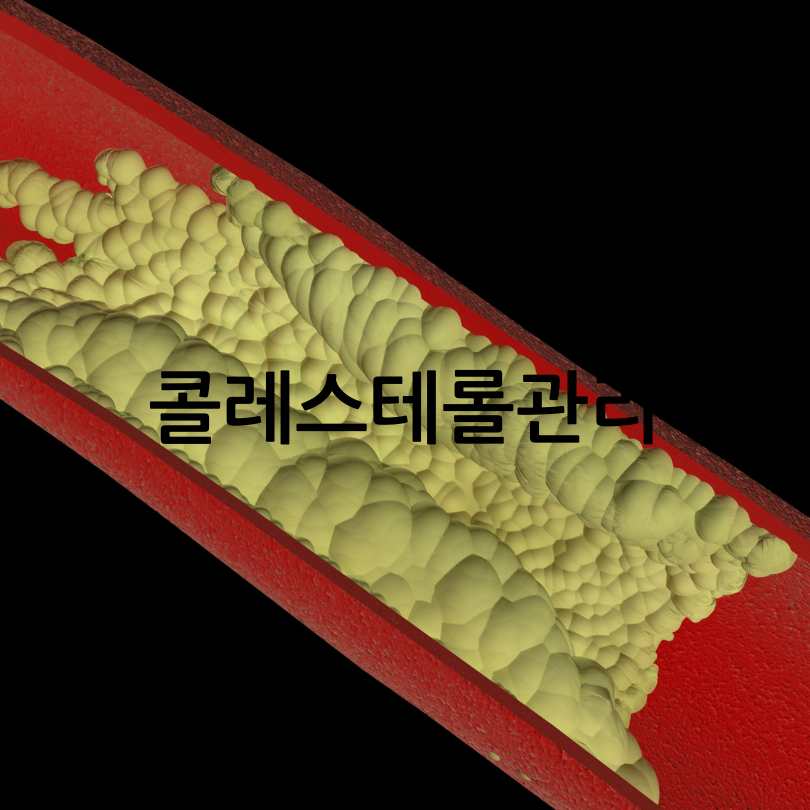 나쁜 콜레스테롤 낮추는 방법