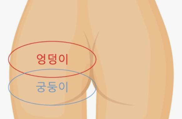 엉덩이 통증&amp;#44; 앉는 것도 고문이었던 3개월의 기록