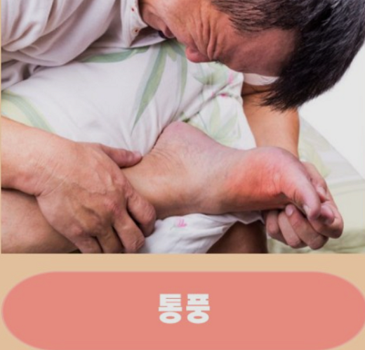 통풍