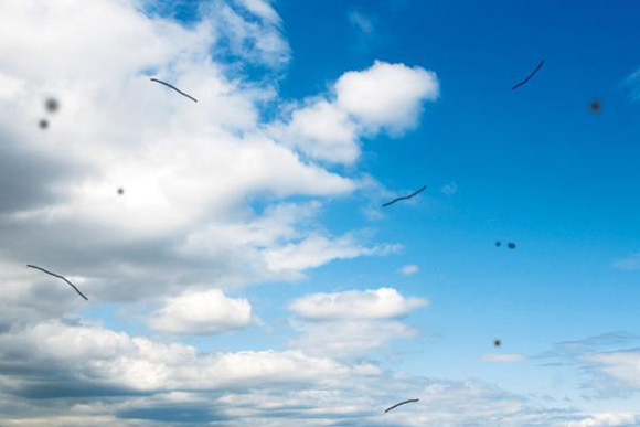 눈에 날파리 현상-비문증