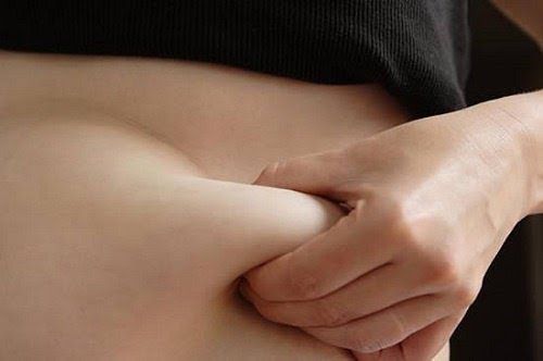 비만