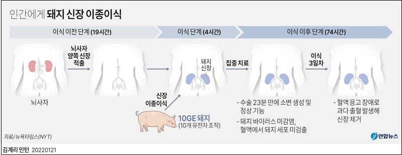 인간에게 사상 최초 돼지 신장 이종 이식 성공 VIDEO Pig-to-human kidney transplant 3D animation
