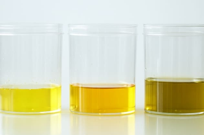 소변 색깔로 보는 건강