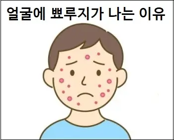 얼굴에 뾰루지가 나는 이유