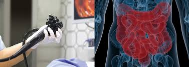 대장내시경 비용 총정리