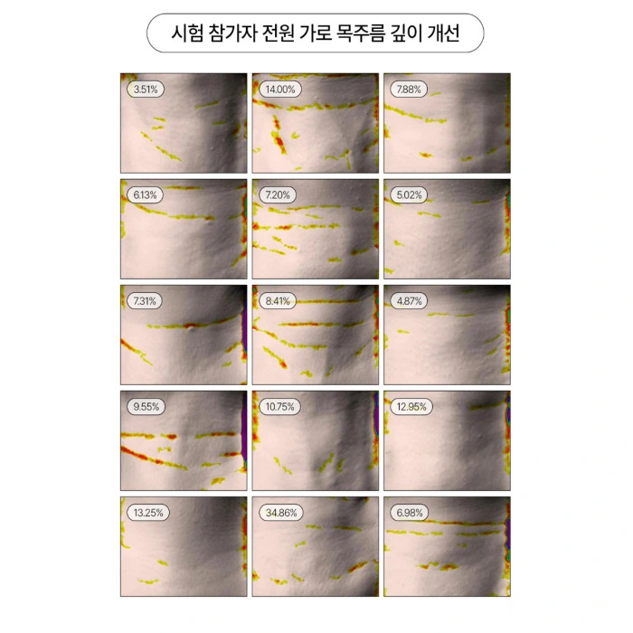 프롬메디 넥마스크 내돈내산 후기 부작용 성분 효과 사용법 가격