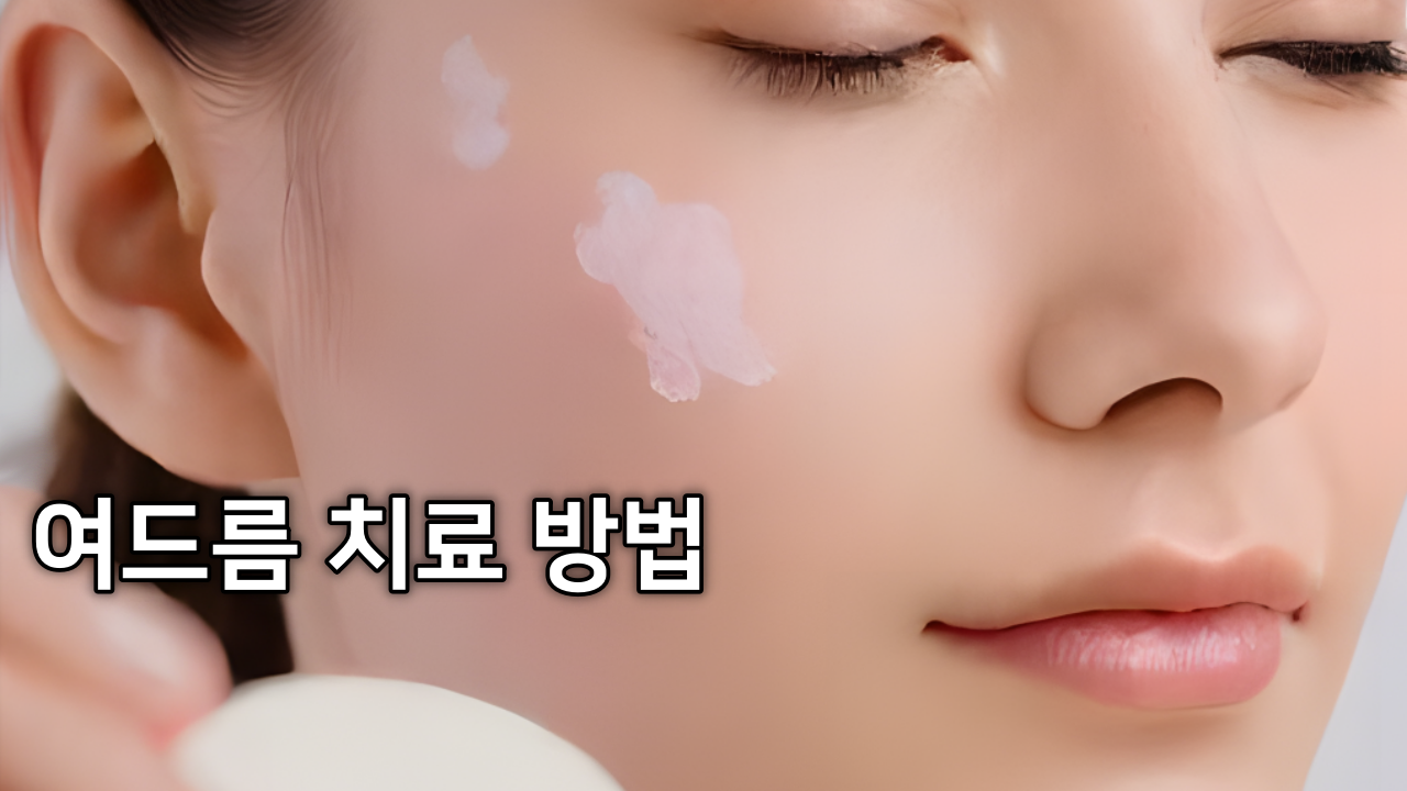 여드름 치료 방법 + 무 즙으로 천연 여드름 피부 관리 효과, 흉터 예방